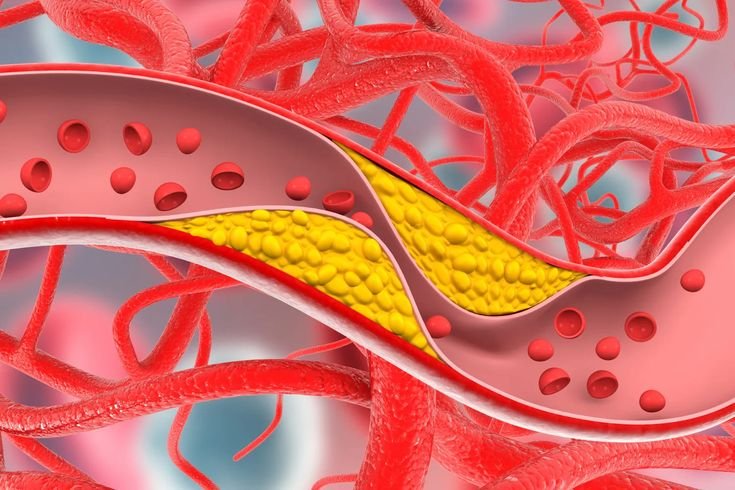 कोलेस्ट्रॉल कंट्रोल करने की देशी दवा: 5 देसी नुस्खे (Desi Remedies to Control Cholesterol)