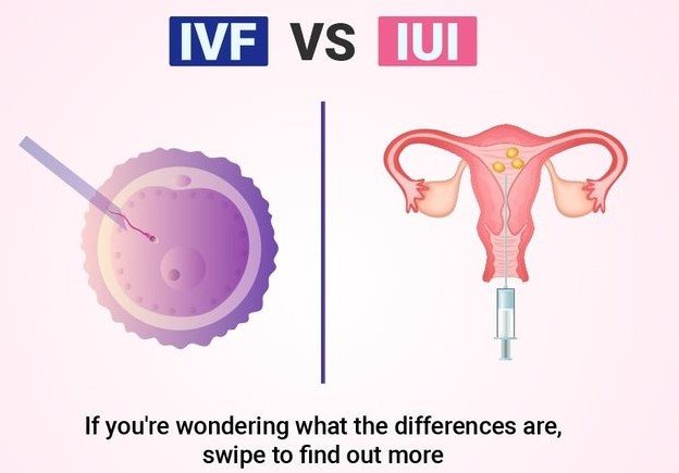 IUI aur IVF mein kya antar hai? प्रक्रिया, खर्च और सफलता दर