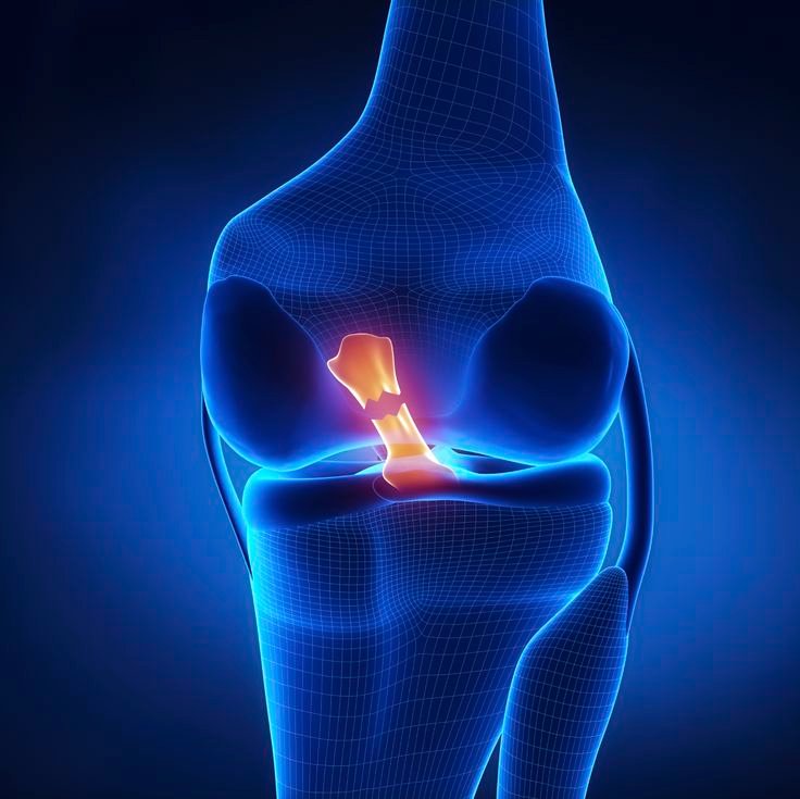 Total Knee Replacement Surgery ke Baad Kis Tarah Rakhein Khayal (Post-Surgery Care After Total Knee Replacement)